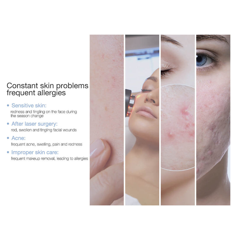 Skin Treats Recombinant Human Collagen Wound Dressing 4